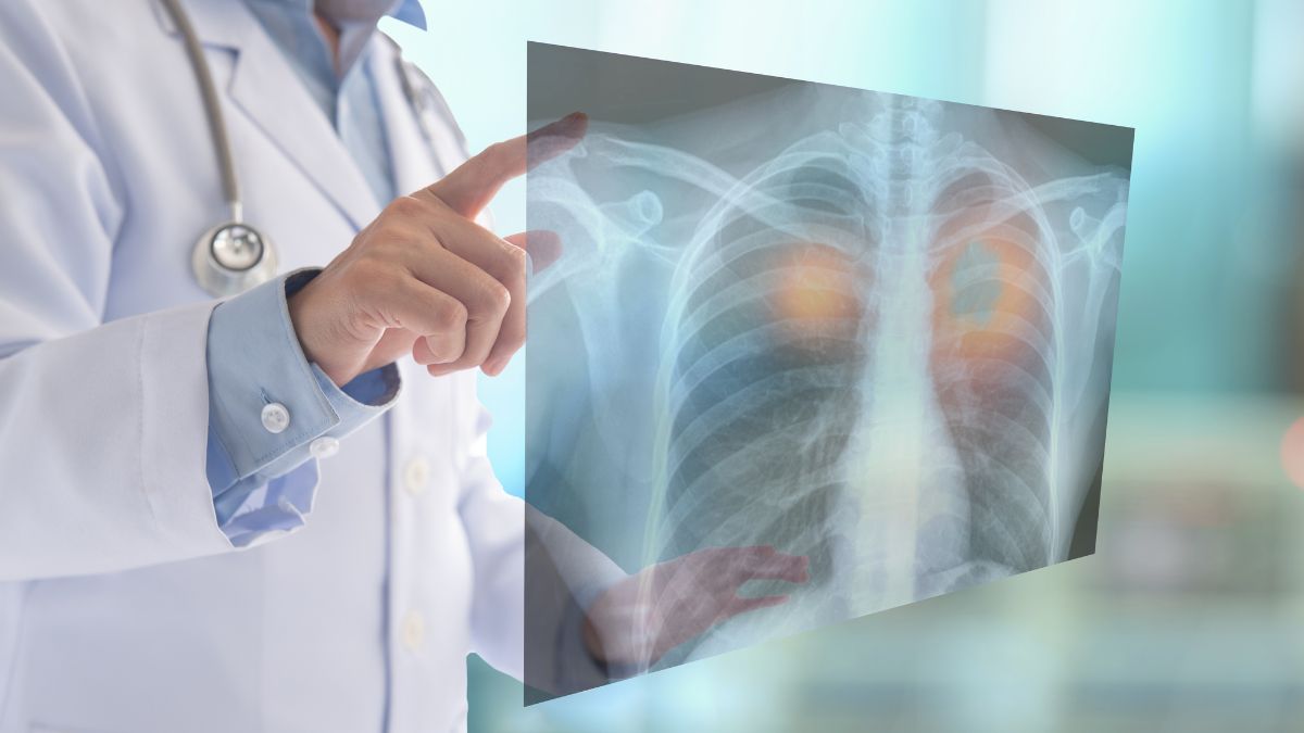 Lung Cancer: இந்த அறிகுறிகள் இருந்தால் நுரையீரல் புற்றுநோய் வர வாய்ப்பா?