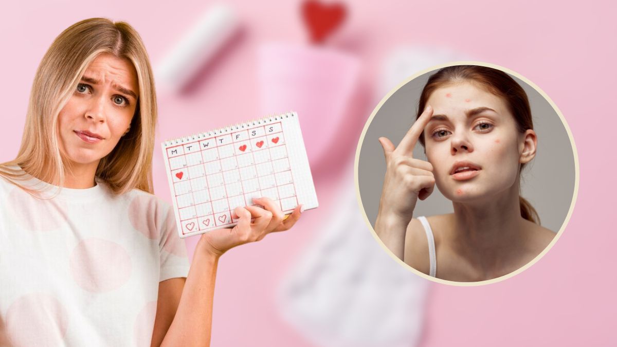 Skin Condition During Periods: மாதவிடாய் சமயத்தில் சரும பிரச்சனையா? அதுக்கு இத செய்யுங்க.